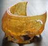Fabbers Archive: Fractured skull